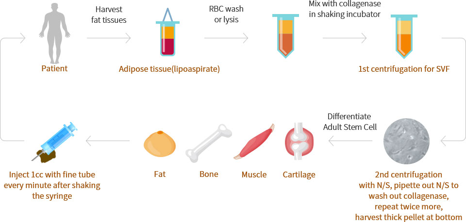 Patient - Harvest fat tissues - Adipose tissue(lipoaspirate) - RBC wash or lysis - Well mix with collagenase in shaking incubator - 1st centrifugation for SVF - 2nd centrifugation with N/S then pipette out N/S to wash out ollagenase, 2 times more Harvest thick pellet at bottom - Differentiate Adult Stem Cell - Fat, Bone, Muscle, Cartilage - Injection with fine tube as 1cc in every 1 minute after shaking well the syringe